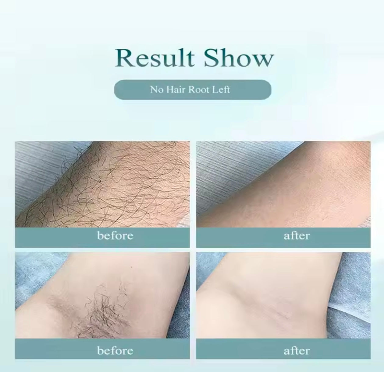 IPL Permanent Laser Hair Removal device for Men and Women Full Body